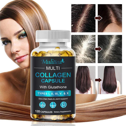 Multiple Collagen with Biotin Support Anti-Aging Skin Hair Nails and Joints Health Antioxidant Skin Firming Support
